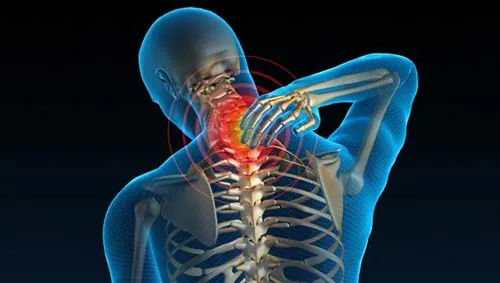 Đau cổ vai gáy: Cảnh báo thoát vị đĩa đệm cột sống