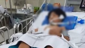 Bé trai 10 tuổi hôn mê sâu sau khi bị nhánh cây rơi trúng đầu