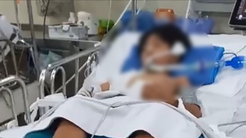 Bé trai 10 tuổi hôn mê sâu sau khi bị nhánh cây rơi trúng đầu