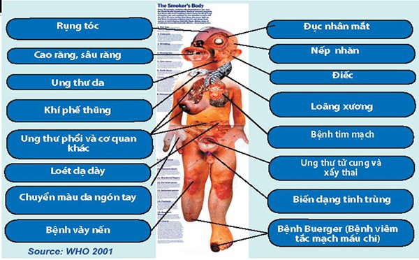 Nguy Cơ Bệnh Tật Khi Hút Thuốc Lá